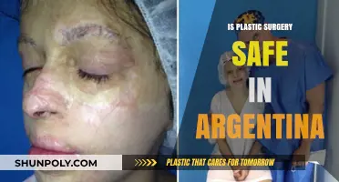 Is Plastic Surgery in Argentina Safe? Risks, Benefits, and Expert Insights