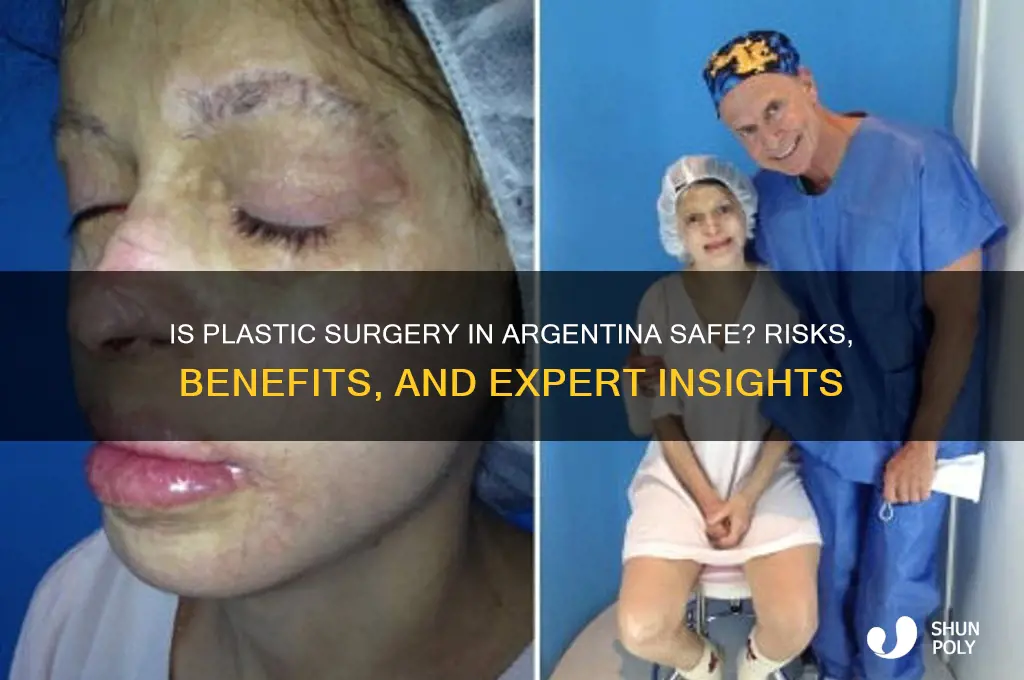 is plastic surgery safe in argentina