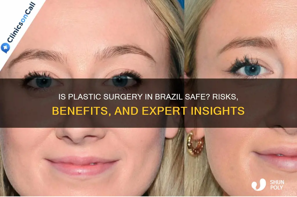 is plastic surgery safe in brazil