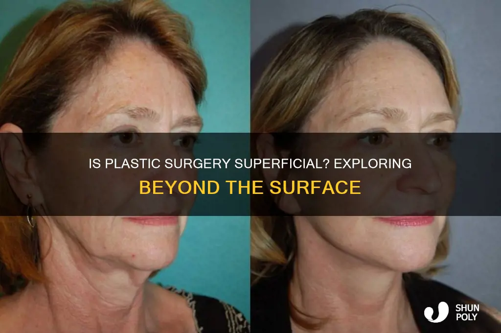 is plastic surgery superficial