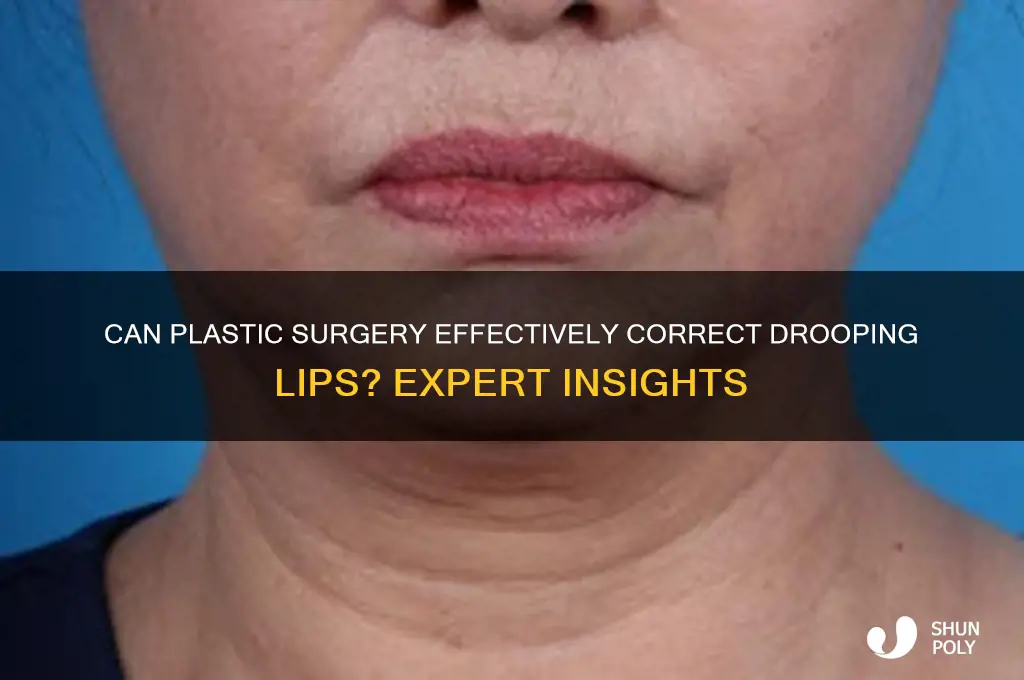 is plastic surgery used to fix drooping lips