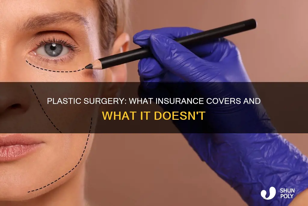is plastic surgey covered by insurance