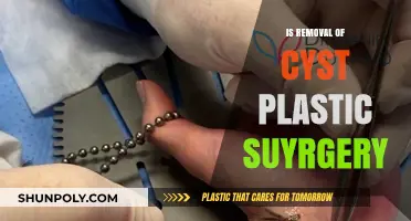 Is Cyst Removal Considered Plastic Surgery? Exploring the Procedure and Classification