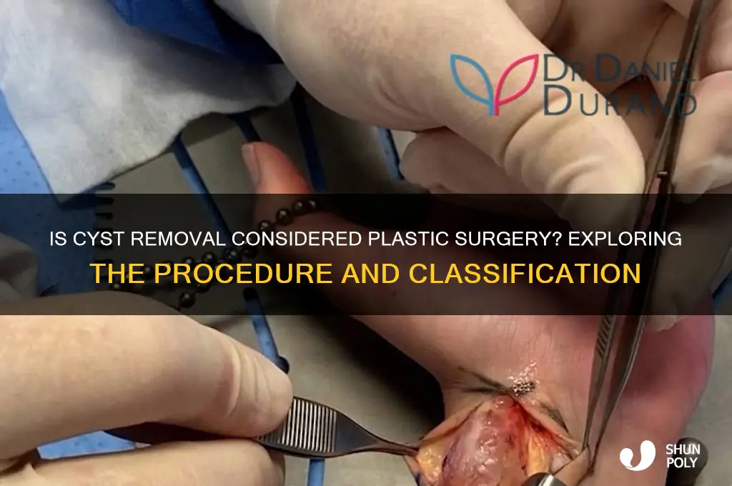 is removal of cyst plastic suyrgery