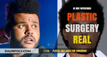 Is Weekend's Plastic Surgery Real? Unveiling the Truth Behind the Rumors