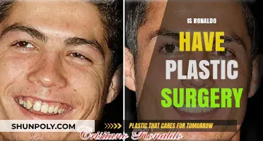 Did Cristiano Ronaldo Undergo Plastic Surgery? Unveiling the Truth