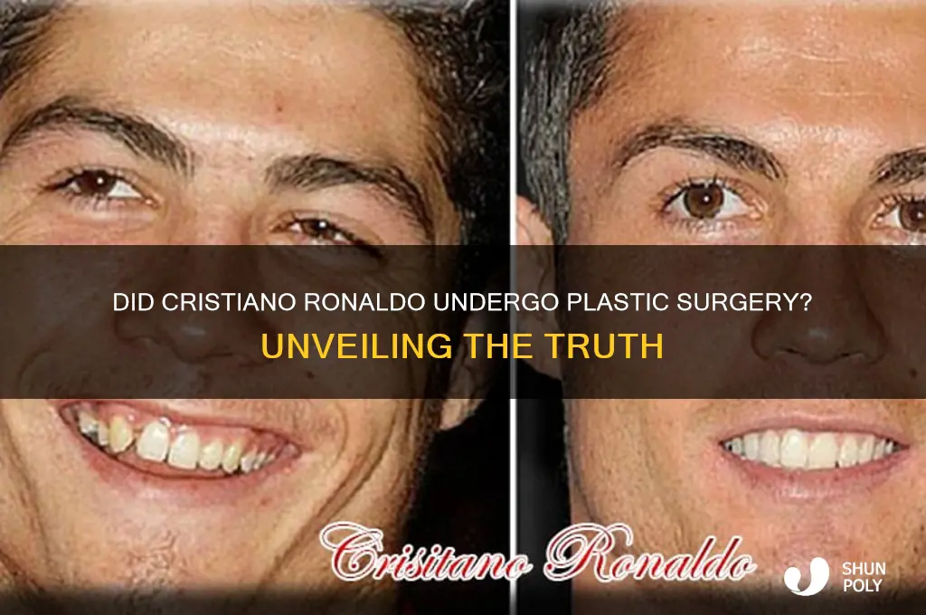 is ronaldo have plastic surgery