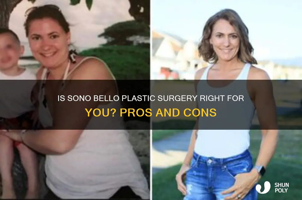 is sono bello plastic surgery