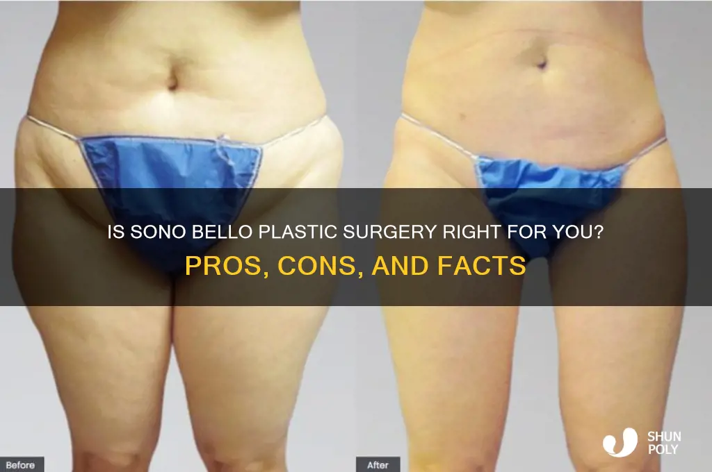 is sonobello plastic surgery