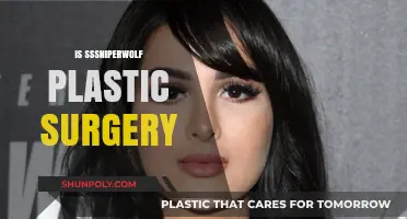 SSSniperwolf Plastic Surgery: Fact-Checking Her Transformation Rumors
