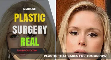 Unveiling the Truth: Is Starlight Plastic Surgery Legitimate or Myth?