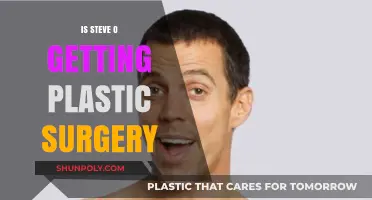 Steve-O's Transformation: Plastic Surgery Rumors and Reality Revealed