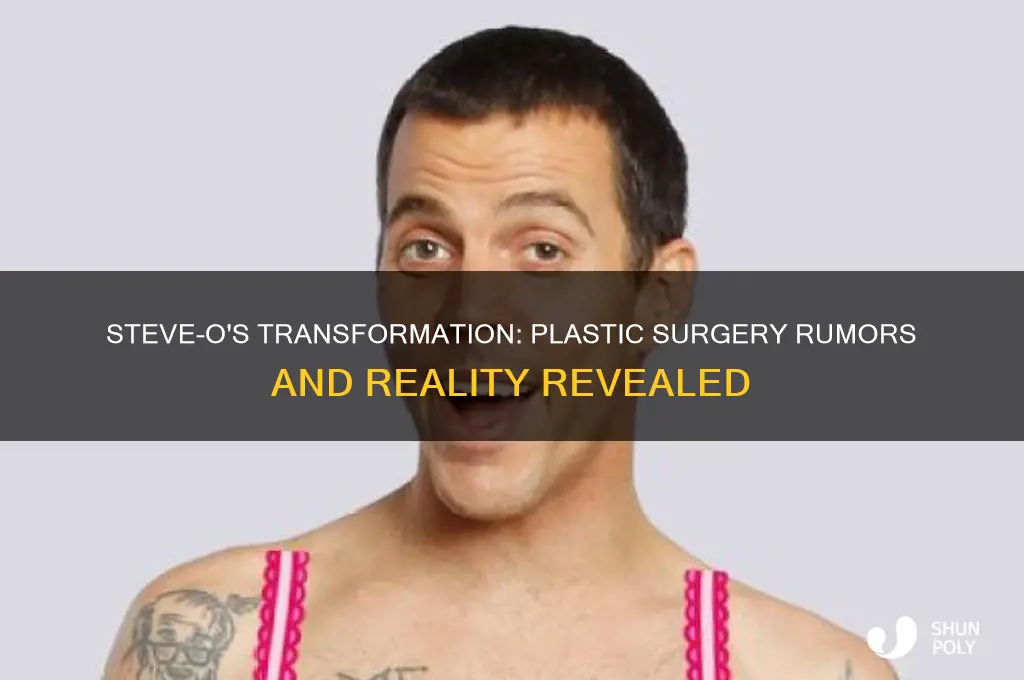 is steve o getting plastic surgery