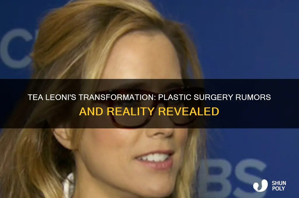 is tea leoni plastic surgery