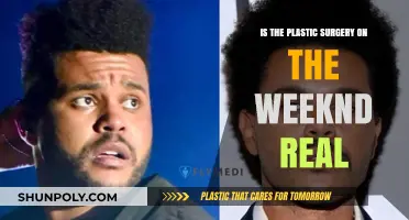 Unveiling The Weeknd's Transformation: Real Plastic Surgery or Illusion?