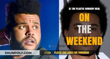 Weekend Plastic Surgery: Unveiling the Reality Behind the Transformation Trend
