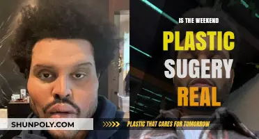 Plastic Surgery: Weekend Makeover, Real Results?