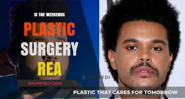 Is The Weeknd's Plastic Surgery Real? Uncovering the Truth