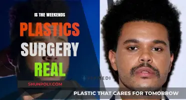 Unveiling the Truth: Did The Weeknd Undergo Plastic Surgery?
