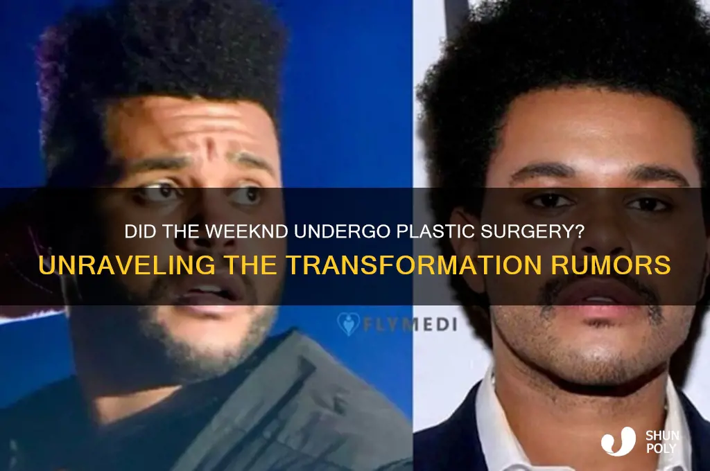 is the weeknd get plastic surgery