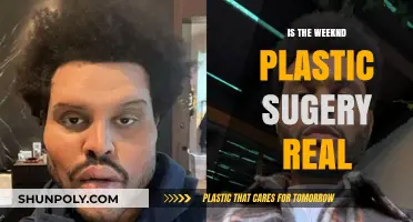 The Weeknd's Plastic Surgery: Real or Fake?