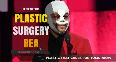 The Weeknd's Plastic Surgery Rumors: Fact or Fiction?