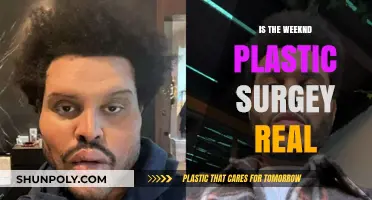 The Weeknd's Plastic Surgery: Fact or Fiction?