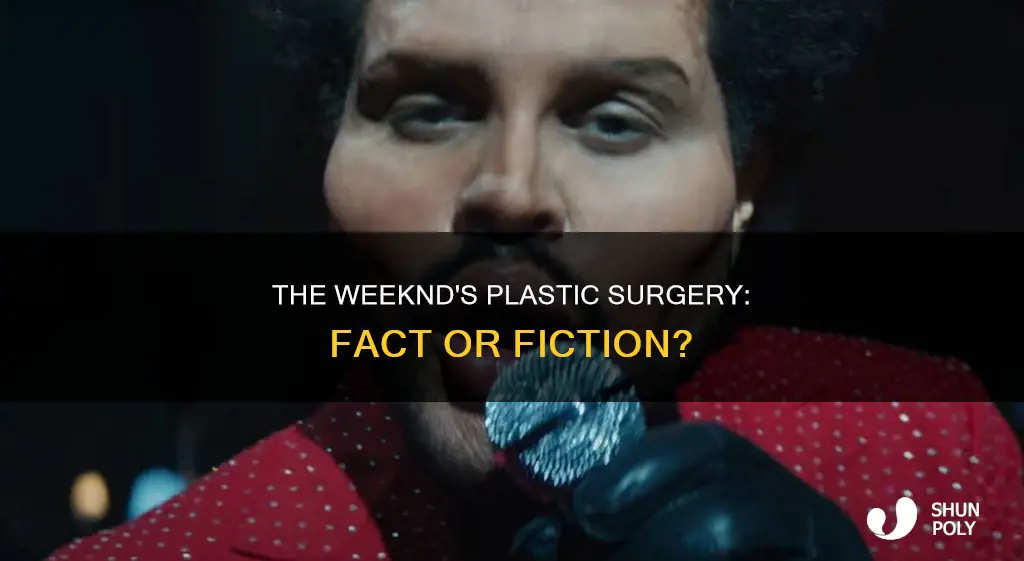is the weeknd plastic surgey real