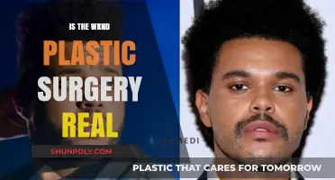 The Weeknd's Transformation: Unveiling the Truth Behind Plastic Surgery Rumors