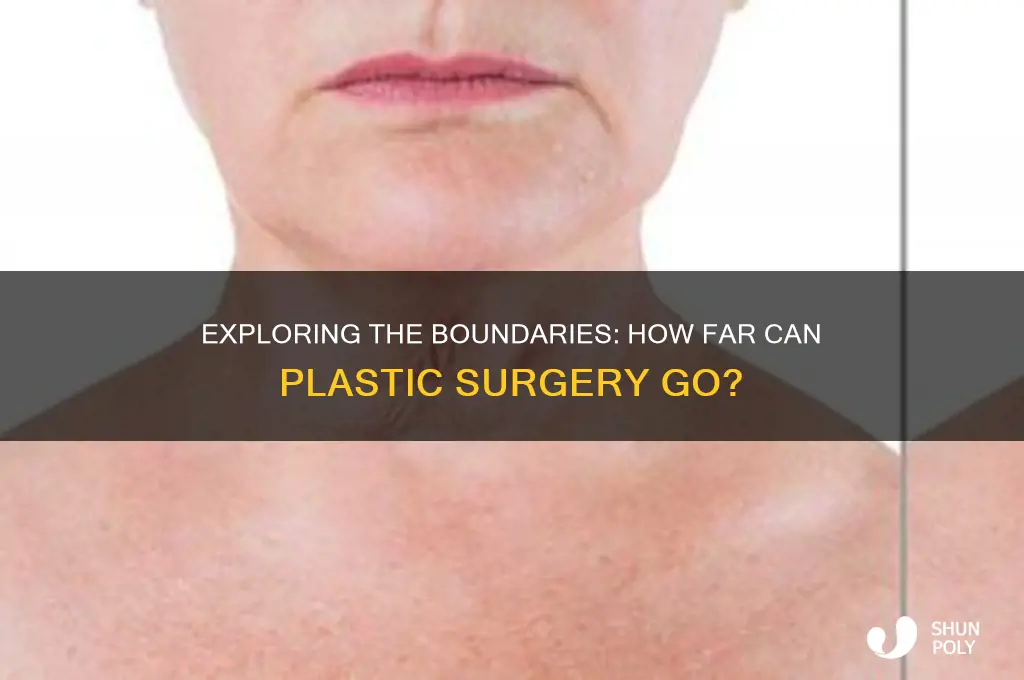 is there a limit to how much plastic surgery