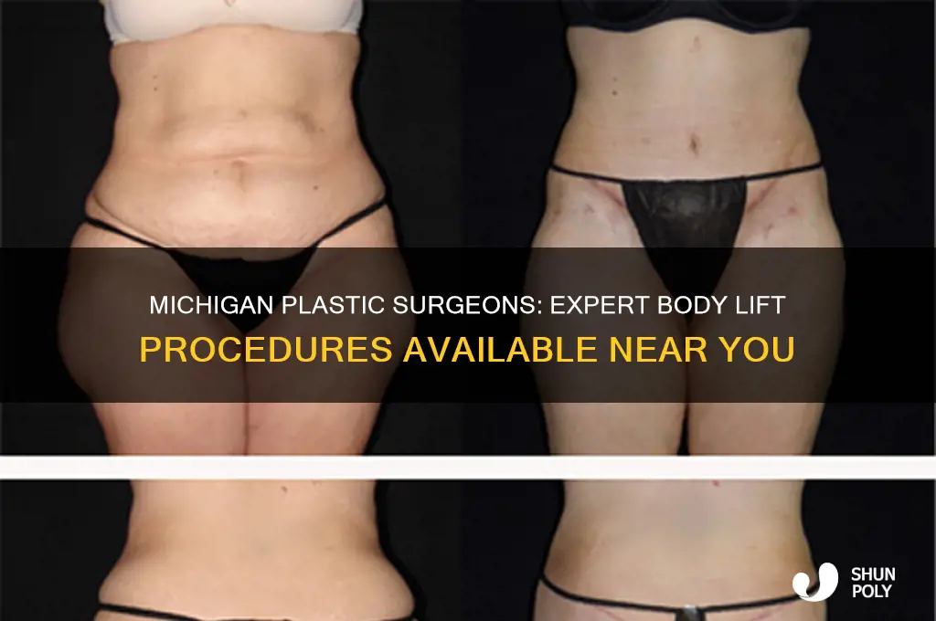 is there a plastic surgeon in michigan do body lift