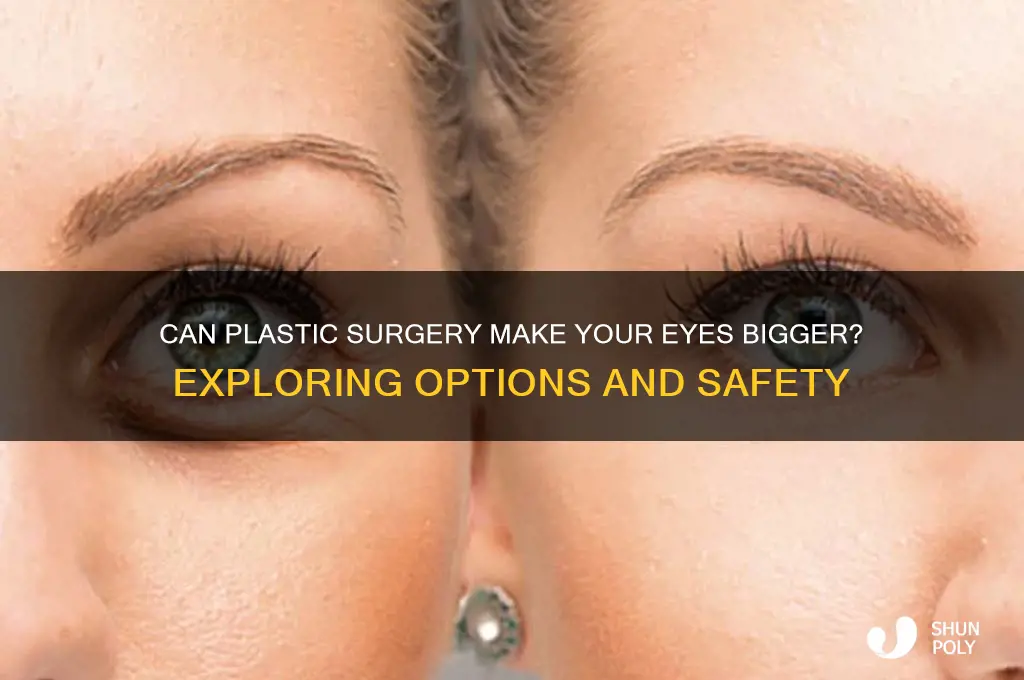 is there a plastic surgery to make your eyes bigger