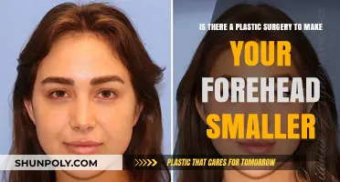 Forehead Reduction Surgery: Can Plastic Surgery Make Your Forehead Smaller?