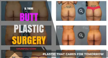 Exploring Butt Plastic Surgery: Trends, Risks, and Transformation Options