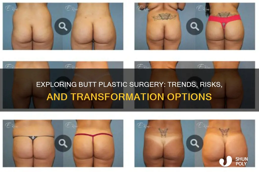 is there butt plastic surgery
