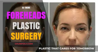 Forehead Plastic Surgery: Exploring Options, Risks, and Transformative Results