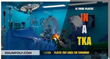 Plastic in TKA: What You Need to Know