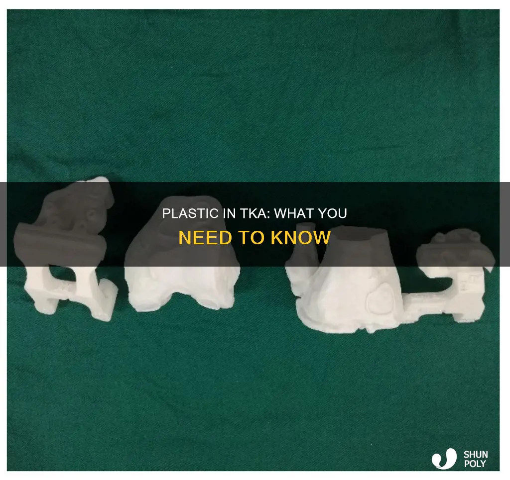 is there plastic in a tka