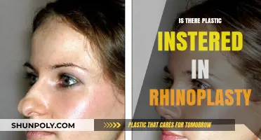 Plastic in Rhinoplasty: What You Need to Know