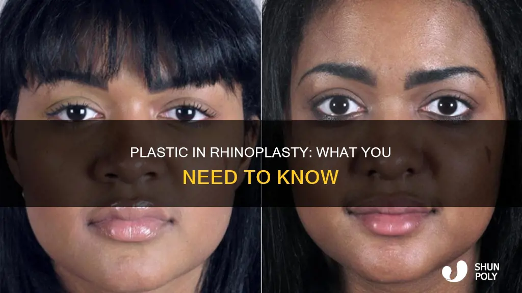 is there plastic instered in rhinoplasty