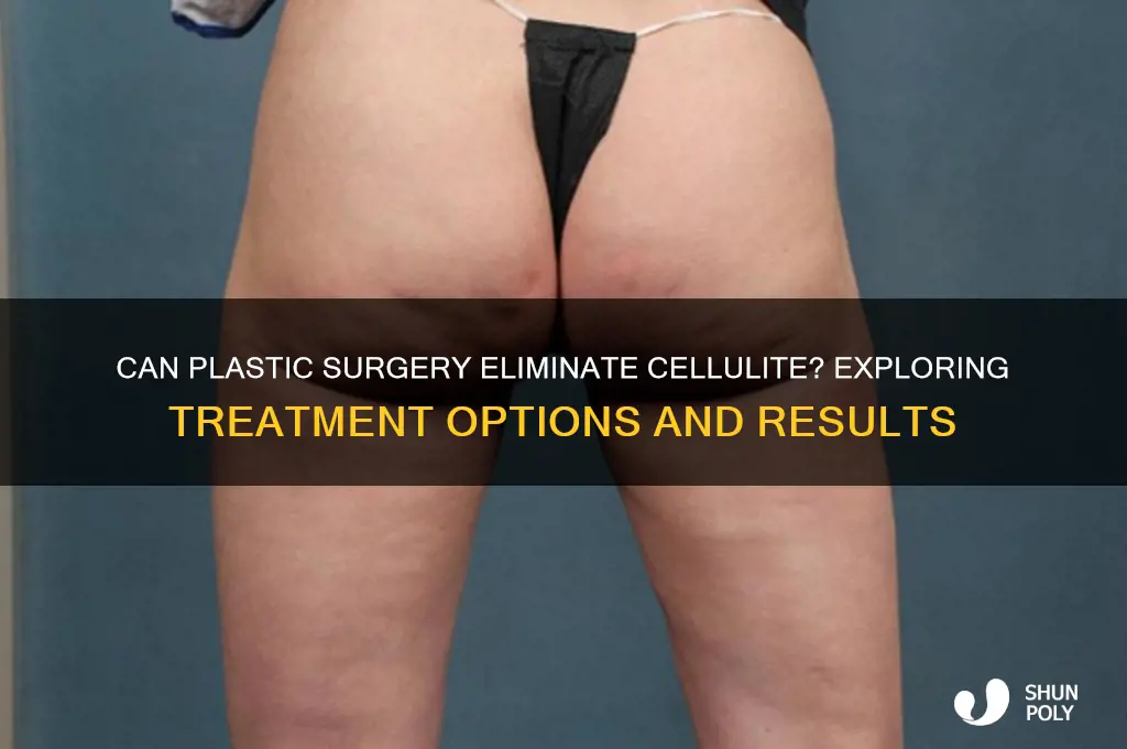 is there plastic surgery for cellulite