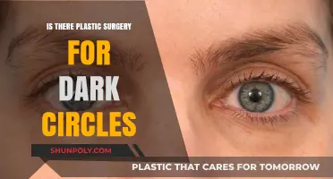 Can Plastic Surgery Eliminate Dark Circles? Exploring Treatment Options
