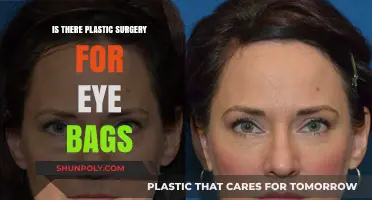 Can Plastic Surgery Effectively Remove Eye Bags? A Comprehensive Guide