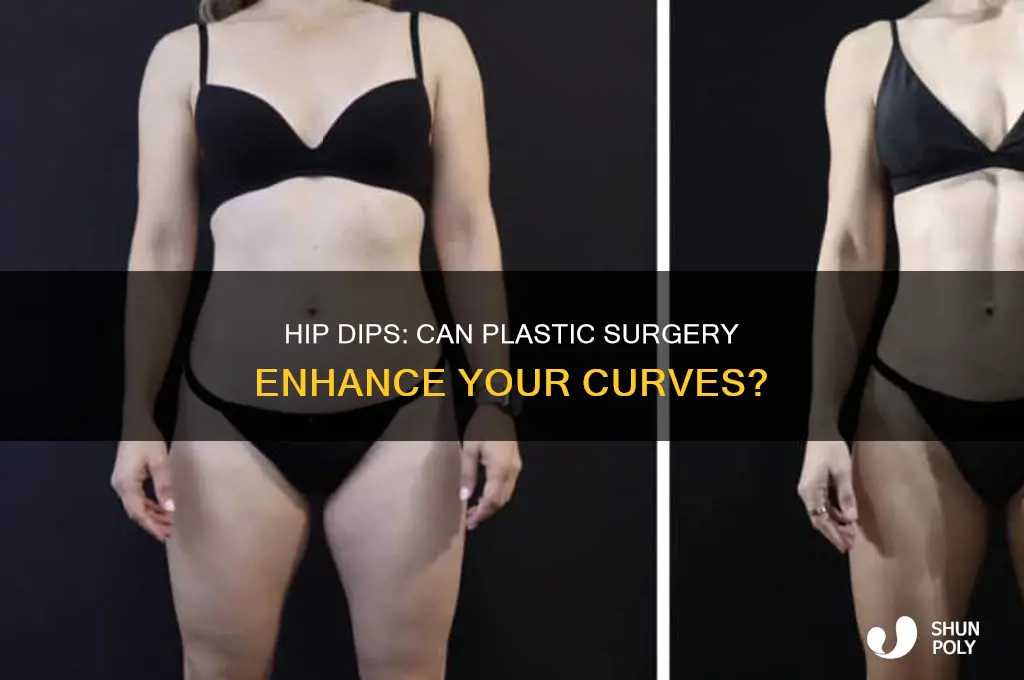 is there plastic surgery for hip dips