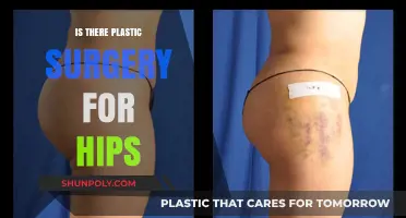 Hip Augmentation: Exploring Plastic Surgery Options for Curvier Hips