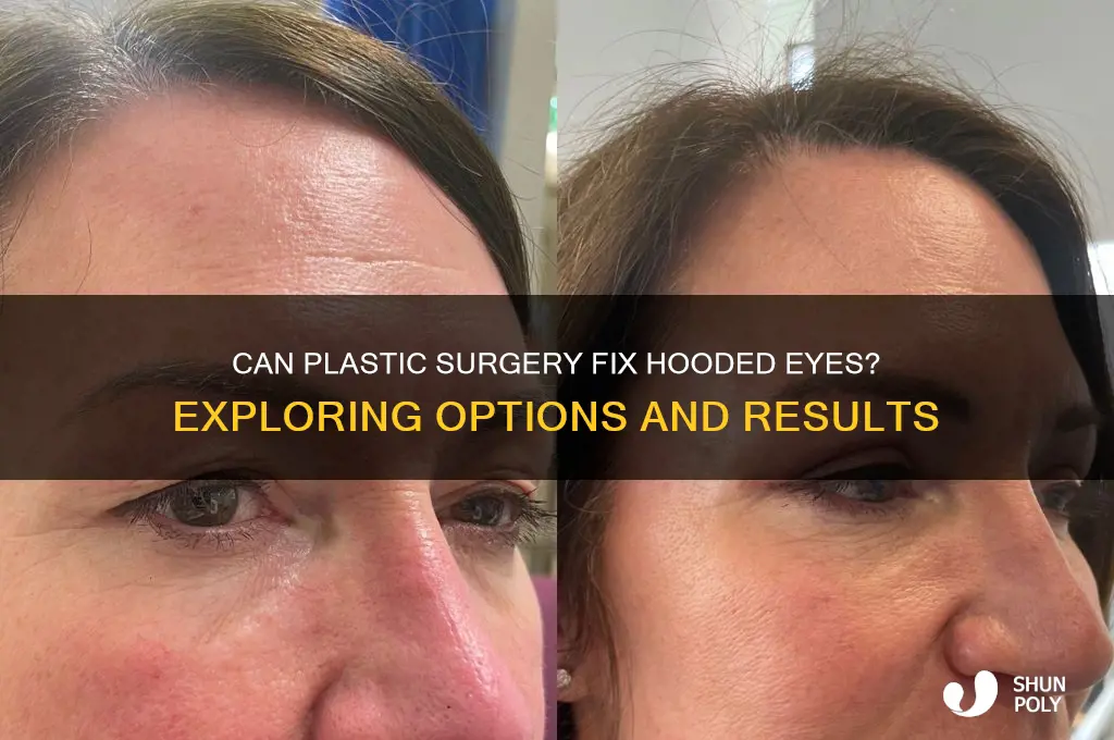 is there plastic surgery for hooded eyes