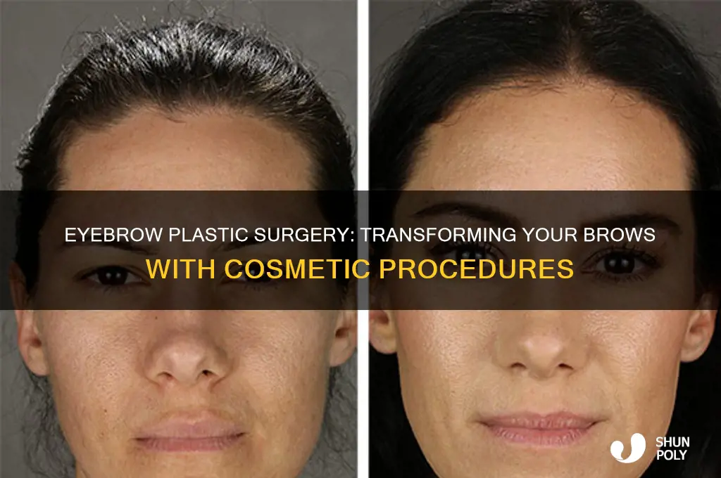 is there plastic surgery for your eyebrows