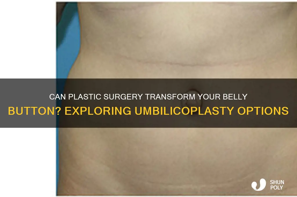 is there plastic surgery to change bellybutton