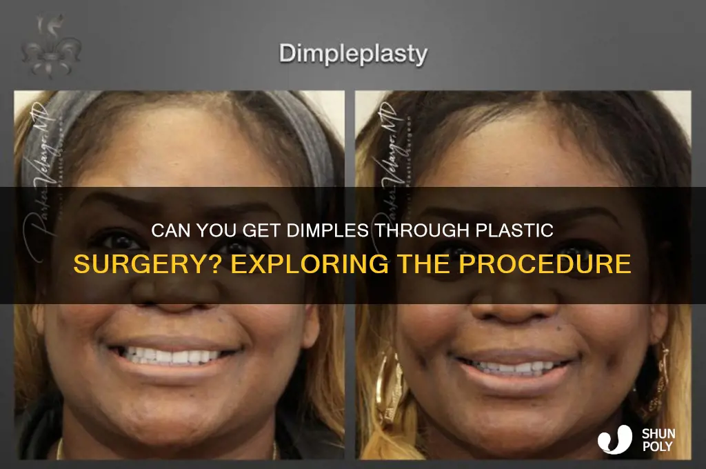 is there plastic surgery to get dimples