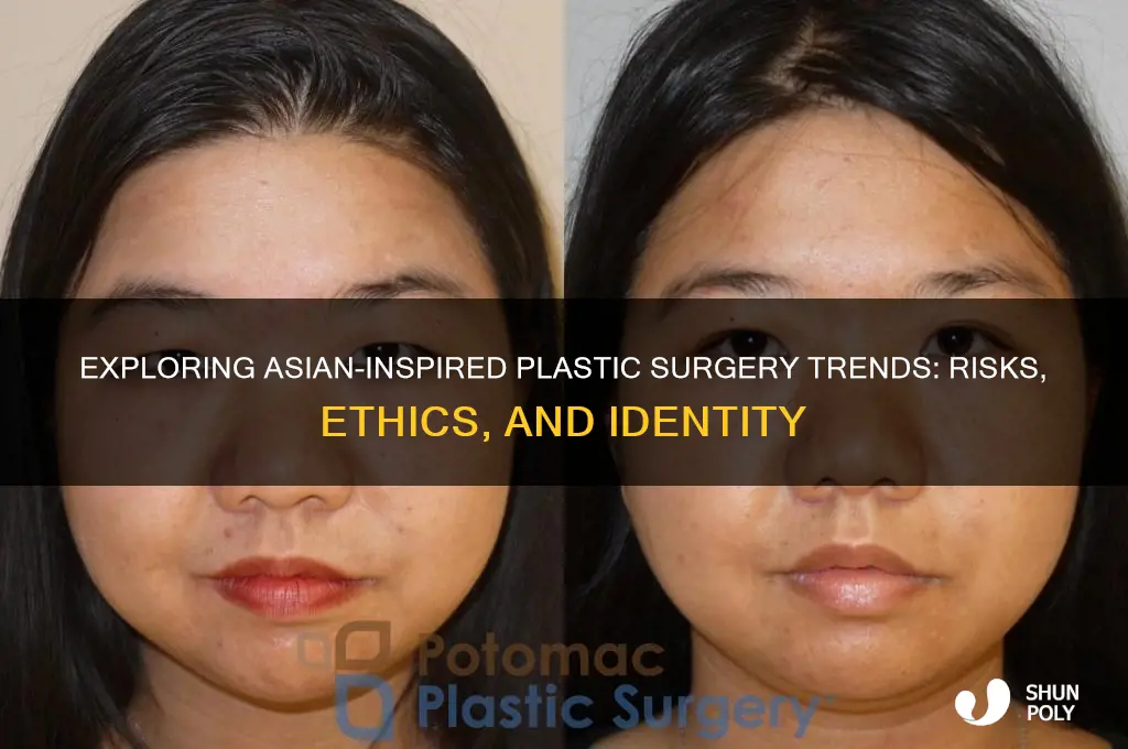 is there plastic surgery to look more asian